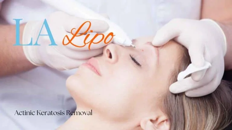 Woman receiving Actinic Keratosis Removal Treatment Shipston-on-Stour