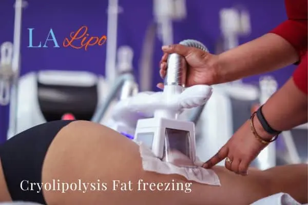 women getting fat freezing Shipston-on-Stour