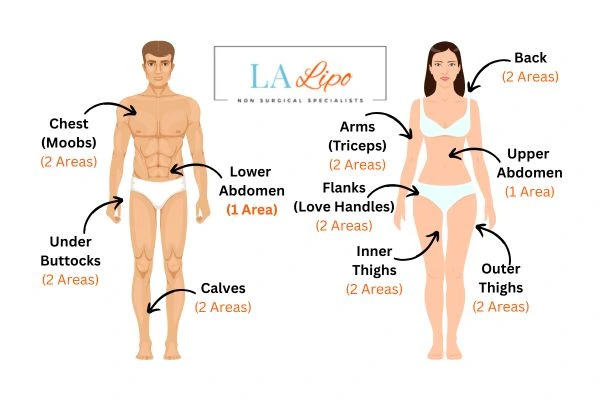 LA LIPO Cryolipolysis Areas Shipston-on-Stour