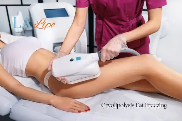 Woman receiving coolsculpting Shipston-on-Stour treatment on her thighs