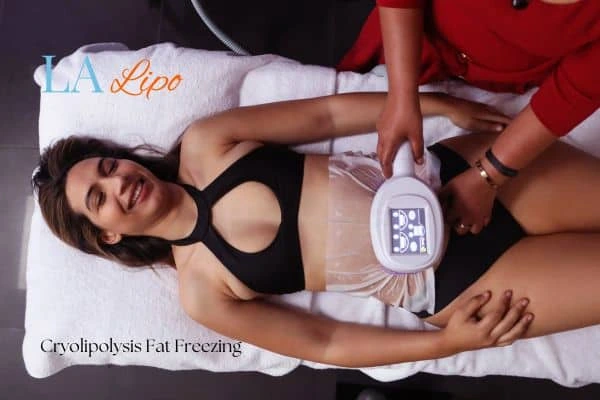woman getting cryolipolysis Shipston-on-Stour
