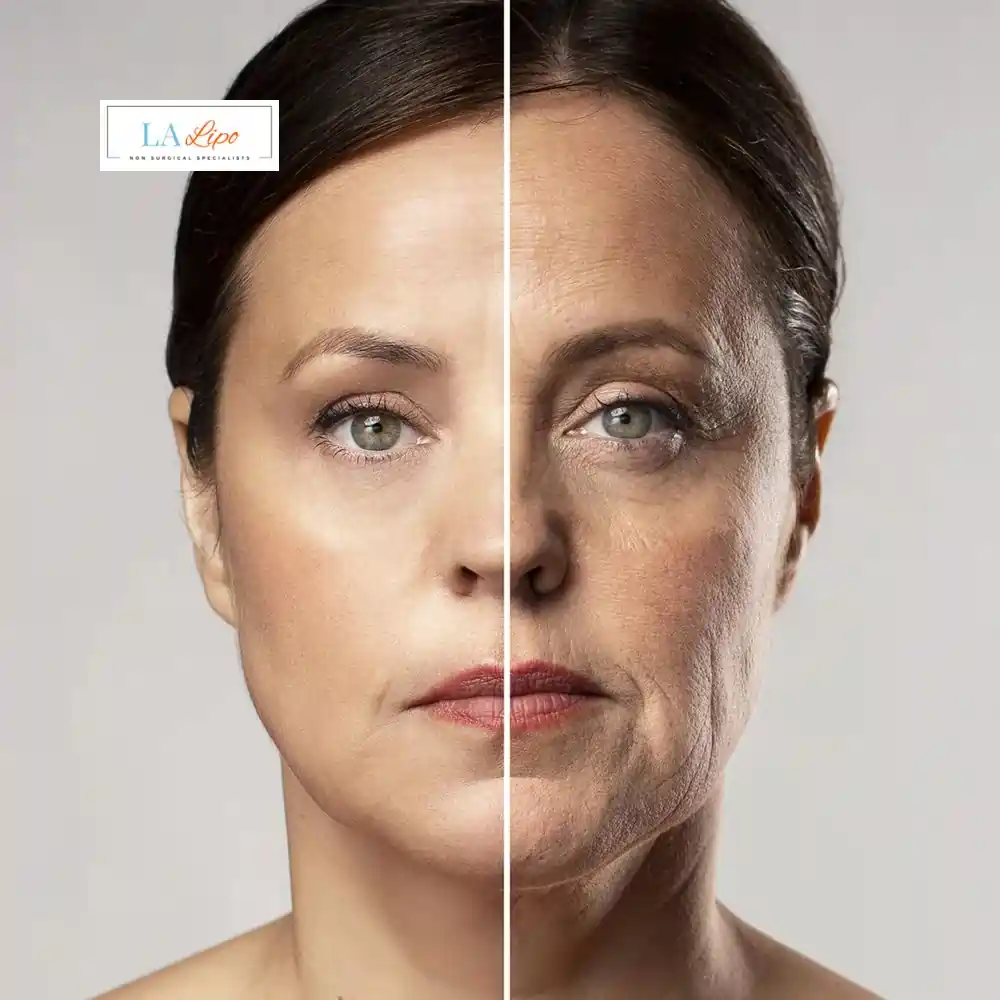 How Can You Tell If Non-Surgical Skin Tightening Is Right for You Shipston-on-Stour?