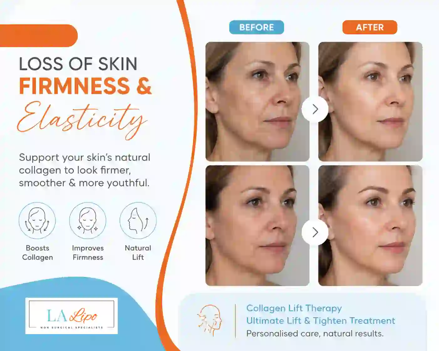 Sign #7: Loss of Skin Firmness and Elasticity Shipston-on-Stour