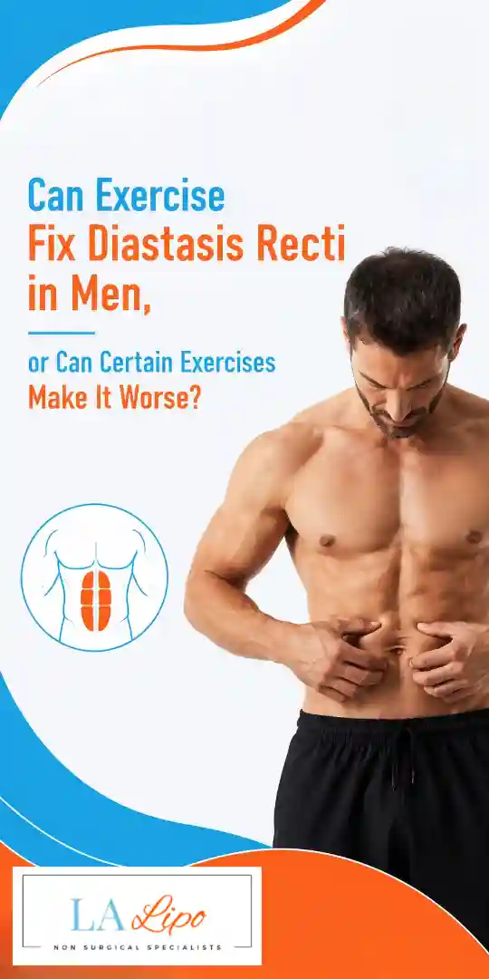 Can Exercise Fix Diastasis Recti in Men, or Can Certain Exercises Make It Worse Shipston-on-Stour?